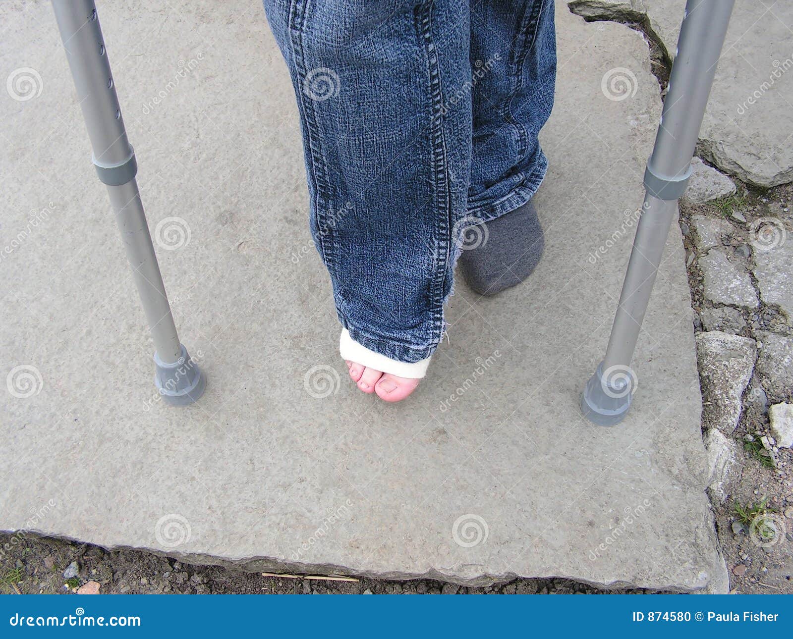 Sprained Ankle & Crutches Stock Photo Image 874580