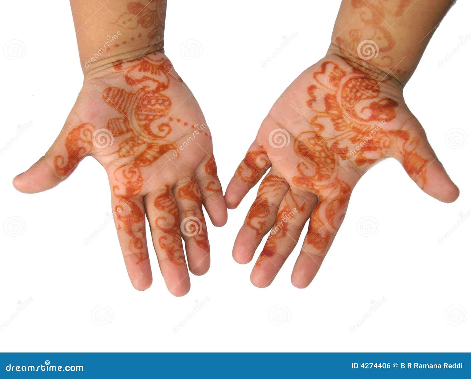 Henna Tattoo Reactions - eMedicineHealth