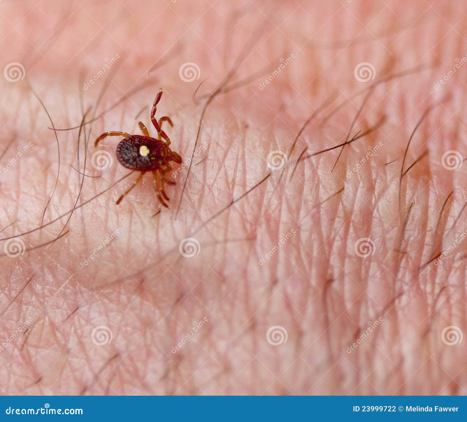 tick skin tick on skin stock photography image 23999722 tick skin tick on skin stock photography image 23999722