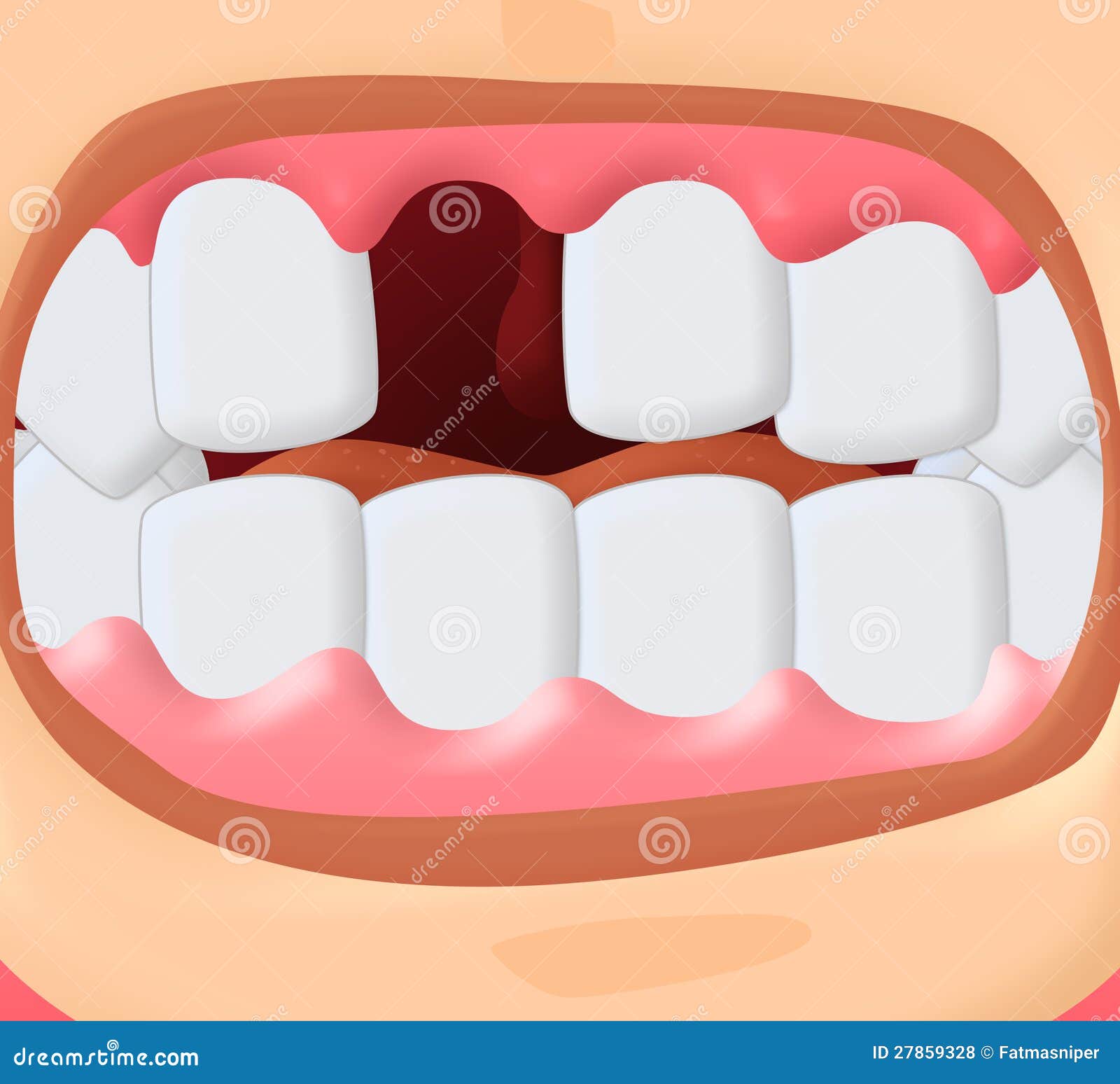 clipart missing tooth - photo #38