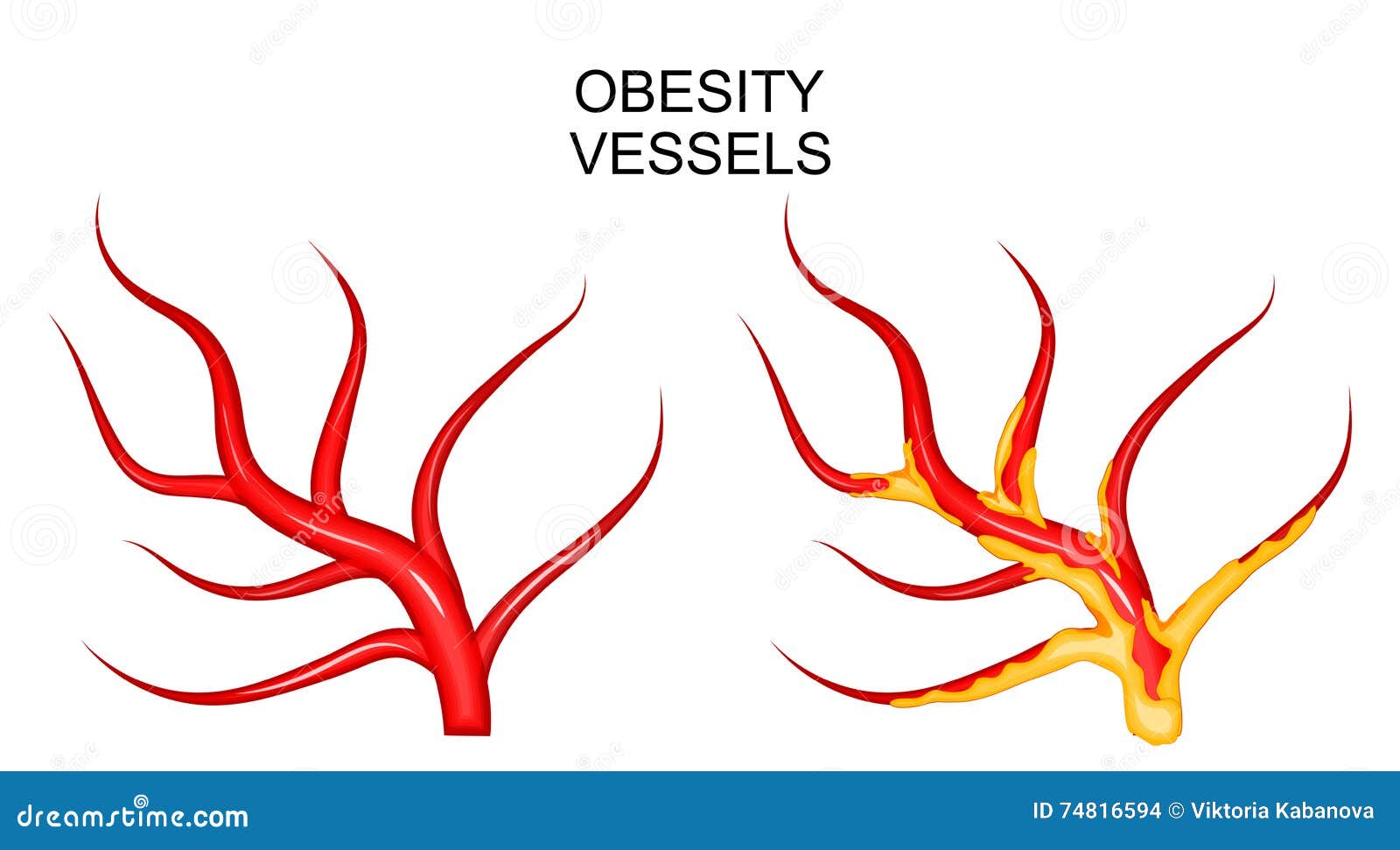 clipart of blood vessels - photo #33