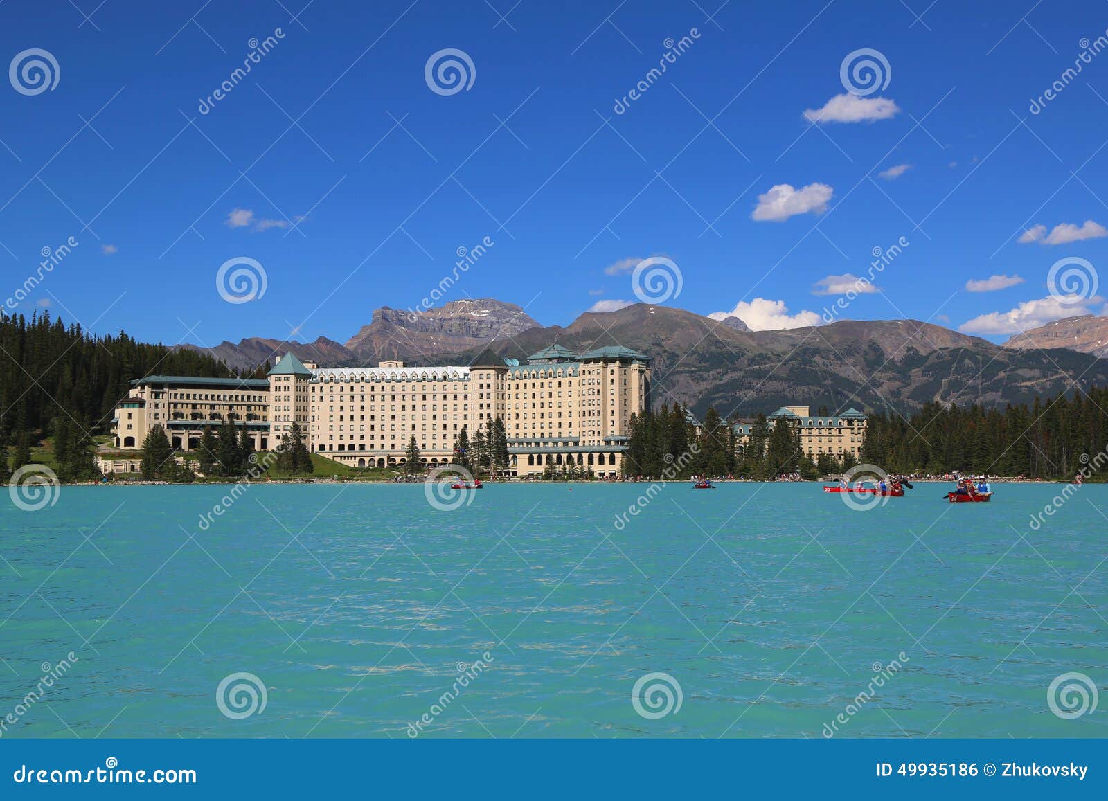 View Of The Famous Fairmont Chateau Lake Louise Hotel Editorial Photo - Image: 49935186
