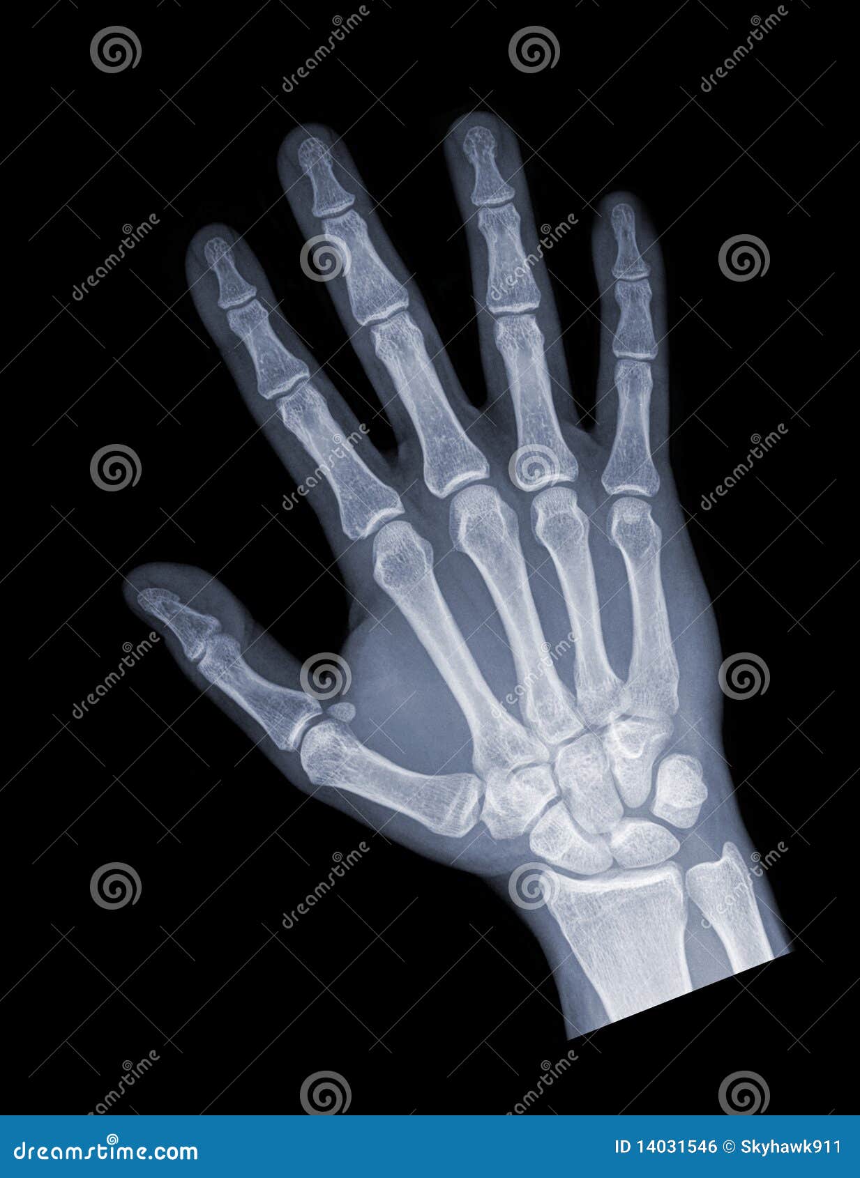 hand x ray clipart - photo #33