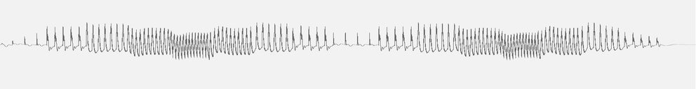 Audio wave