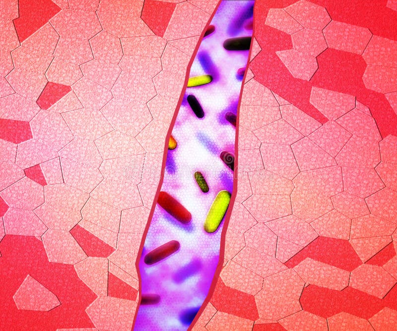 Wunde Stock Illustrationen Vektors Klipart 11 493 Stock Illustrations