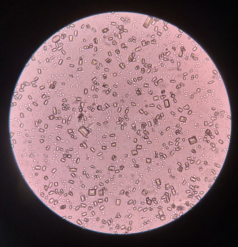 Moderate White Blood Cells Stok Fotoğraflar & Alerji‘nin Daha Fazla Resimleri - 