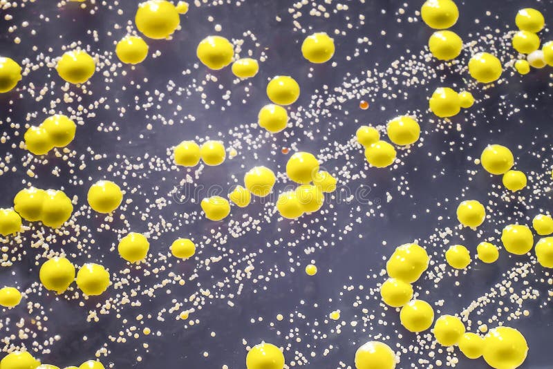 Желтые бактерии. Микрококкус Лютеус колонии. Бактерия Micrococcus luteus. Микрококки Лютеус. Желтый микрококк.