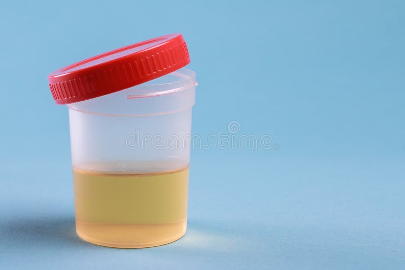 Банка мочи фото 2,809 Urinalysis стоковые фото - бесплатные и стоковые фото RF от Dreamstime - С