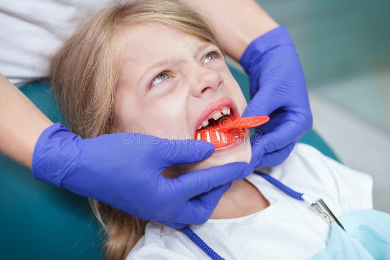 В ленинградской области девочка умерла у стоматолога. Открытый рот у стоматолога. Открытый рот женщин у зубного. Энджи 2 в стоматологии.