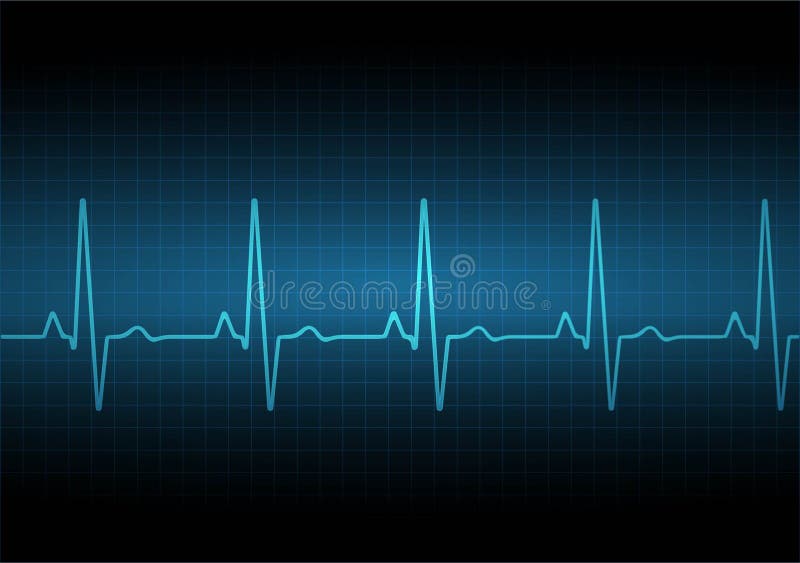 Экг По Фото Онлайн Бесплатно Экг По Фото Онлайн Бесплатно