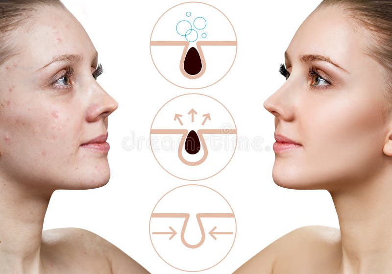 Смас линии. Красивая кожа. S лифтинг. Фотомодель лицо. Skin area.