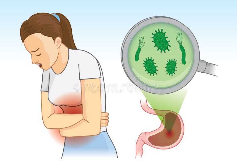 علاج جرثومة المعدة بالأعشاب