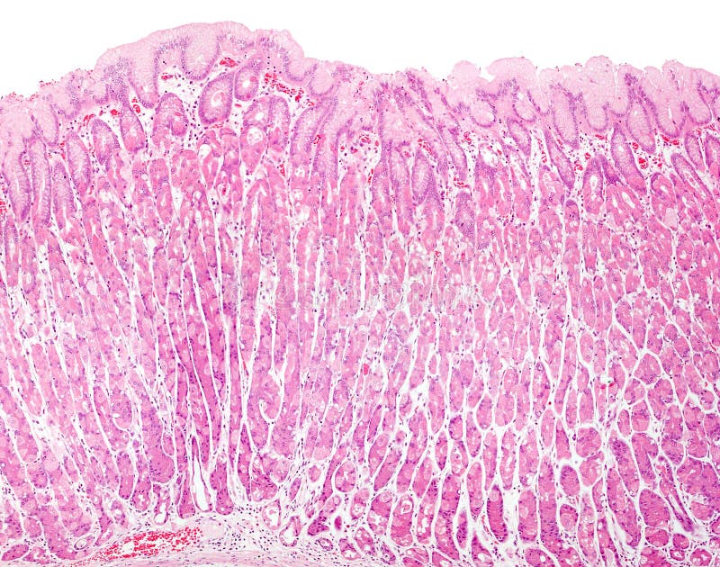 Желудок микрофотография. Мукоциты желудка под микроскопом. Форма клетки слизистой оболочки. Солянокислый гематин с слизистой желудка микрофотография. Барьер слизистая оболочка