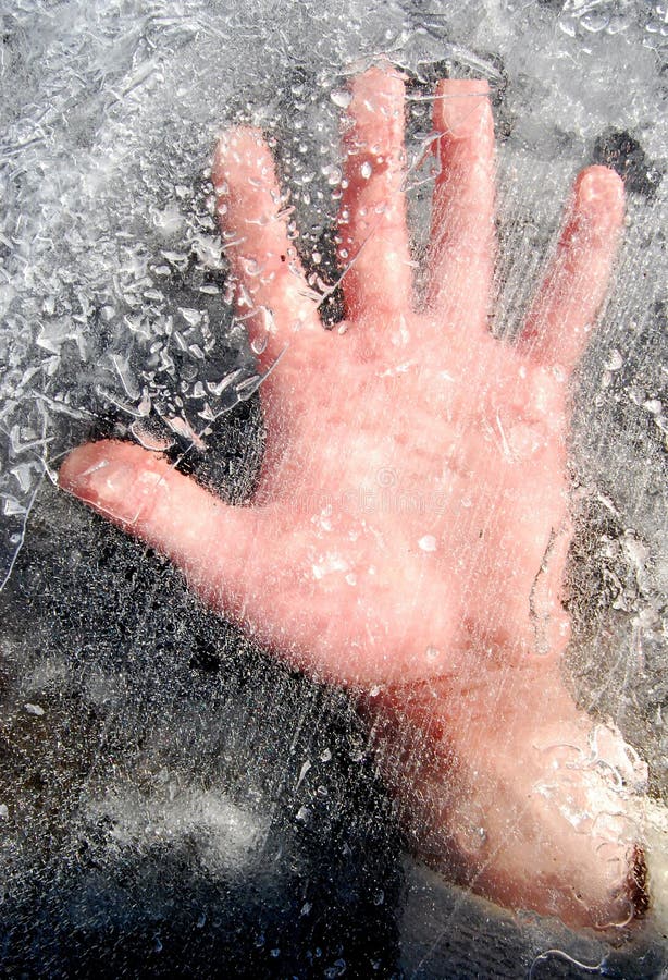 Заморозка руки. Феномен застывшие люди.