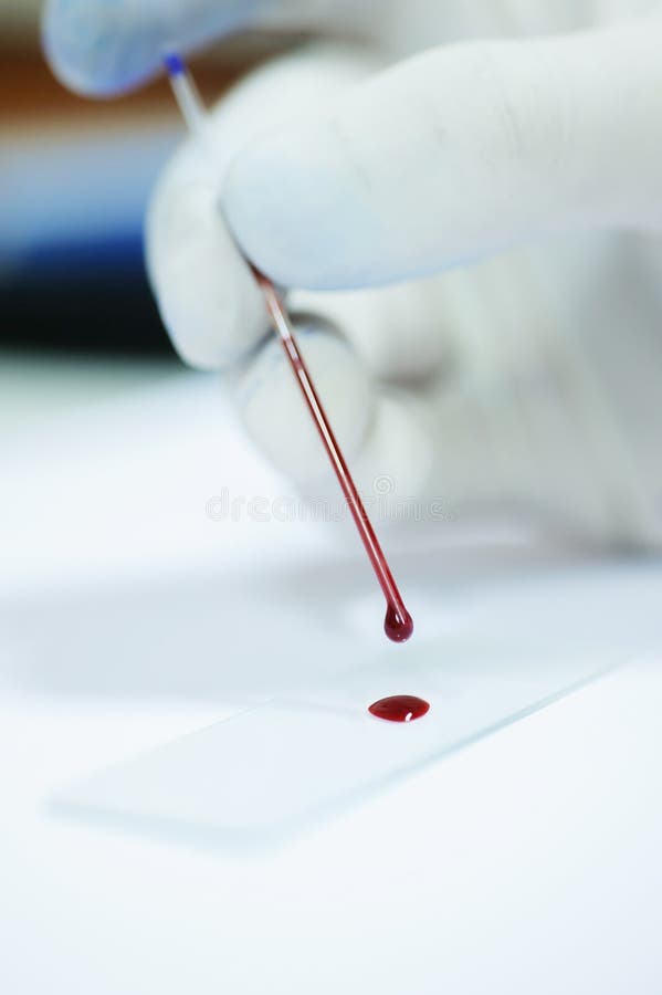 Тест капля крови. Капля крови на предметном стекле. Кровь на стекле лаборатория. Исследованиям крови капли. Пробирки с кровью.