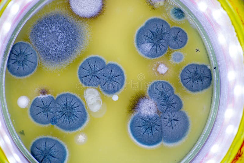 Колонии грибов в чашке петри. Pseudomonas aeruginosa на чашке Петри. Кокки в чашке Петри. Фузариум на чашке Петри.