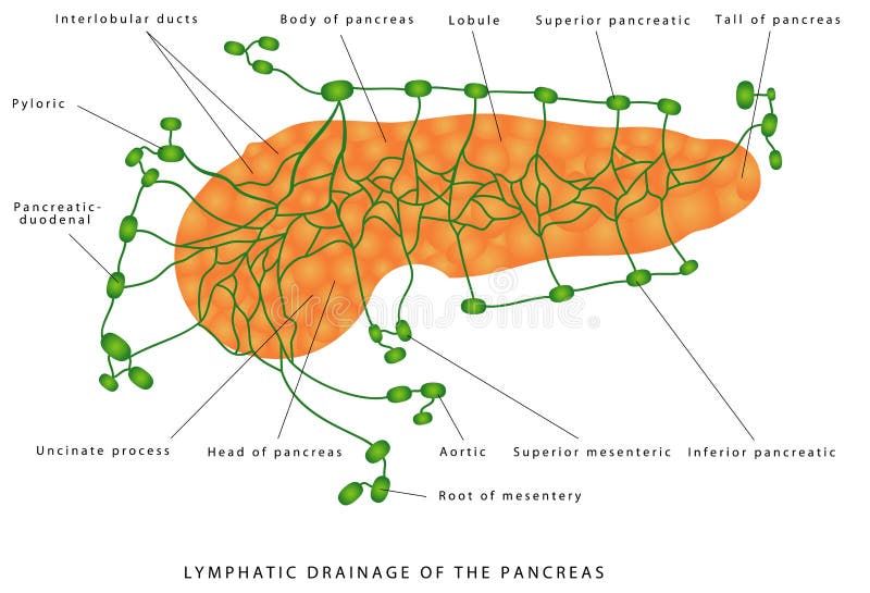 Увеличенные лимфоузлы в печени. Региональные лимфатические узлы поджелудочной железы. Регионарные лимфоузлы поджелудочной железы. Лимфоотток поджелудочной железы схема. Лимфатическая система поджелудочной железы.