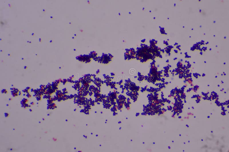 Туберкулез кокки. Грамположительные кокки. Грамм положительные кокки. Грамм положительные кокки под микроскопом.