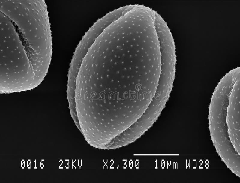 Пыльца под электронным микроскопом. Изображение пыльцы просвечивающий электронным микроскопом. Фото пыльцы с помощью электронный микроскоп. Пыльцевые зерна под микроскопом в моче фото. Черная пыльца