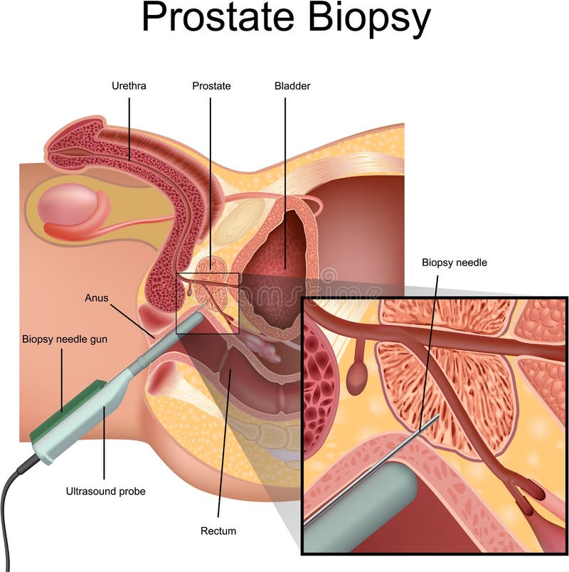 Prostate Stimulated