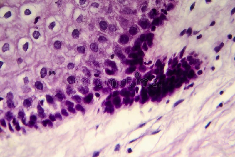 Под микроскопом смотрят шейку Pin en CUERPO HUMANO