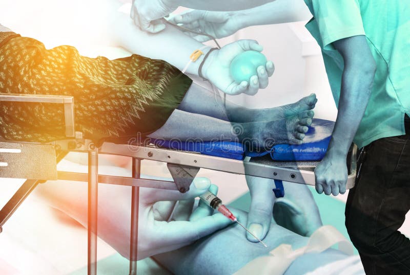 Коля шприц. Золадекс 3. 6 игла. Шприц сфм 5 мл. Золадекс 3.