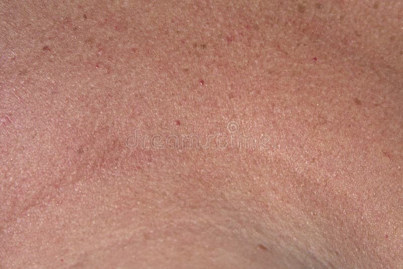 Текстура кожи человеческого лица Стоковое Изображение - изображение  насчитывающей люди, дерматология: 76786839