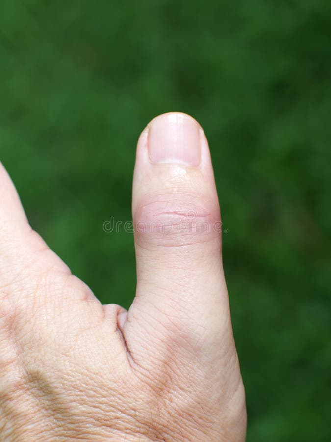 Случаи из практики - Part 2 HANDCLINIC.PRO