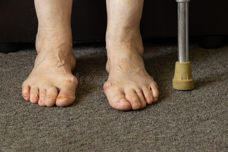 Ноги Старушек Фото