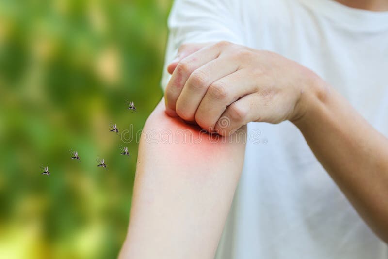 Insect Bites: Learn How to Identify the Various Types