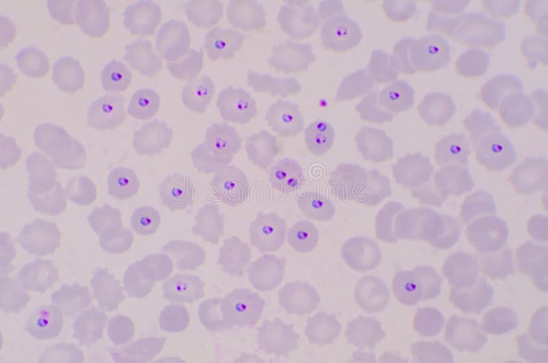 Малярия клетки. Плазмодий Вивакс. Plasmodium falciparum шизонт. Малярийный плазмодий. Plasmodium falciparum на стадии кольца.