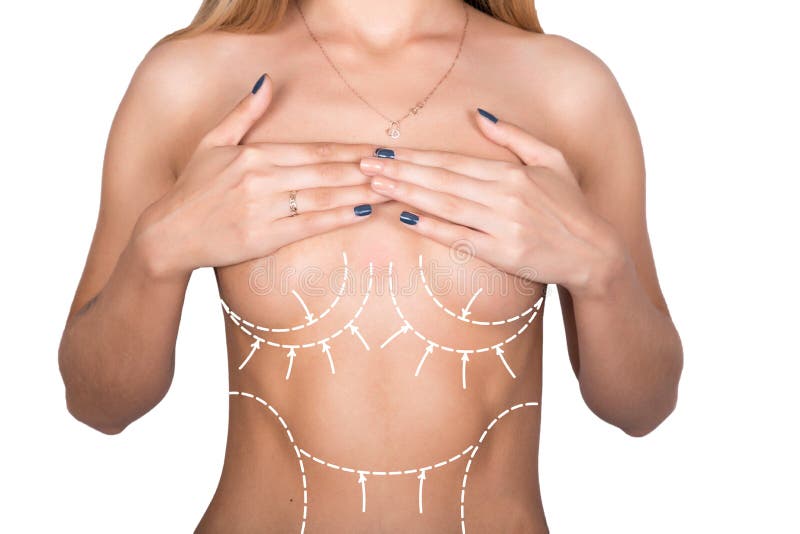 塑料或整容外科 脂肪团更正 人们和bodycare概念与线的女性胸象胸骨库存照片 图片包括有爱好健美者 臀部
