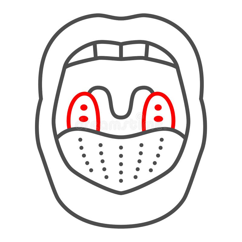 扁桃体细线图标人类疾病概念扁桃体炎在白背景喉病上的标志向量例证 插画包括有关心 病症 扁桃体细线图标人类疾病概念扁桃体炎在白背景喉病上的标志向量例证 插画包括有关心 病症