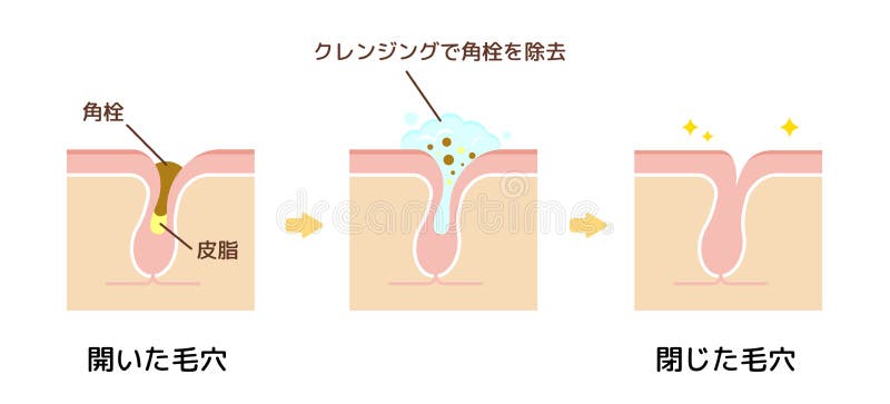 头皮 正常头发的结构图向量例证 插画包括有皮肤 问题 循环 医学 健康 滤泡 医疗