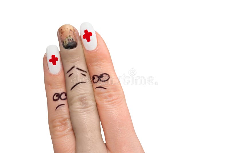 Three fingers playing a role of doctors and patient. Three fingers playing a role of doctors and patient