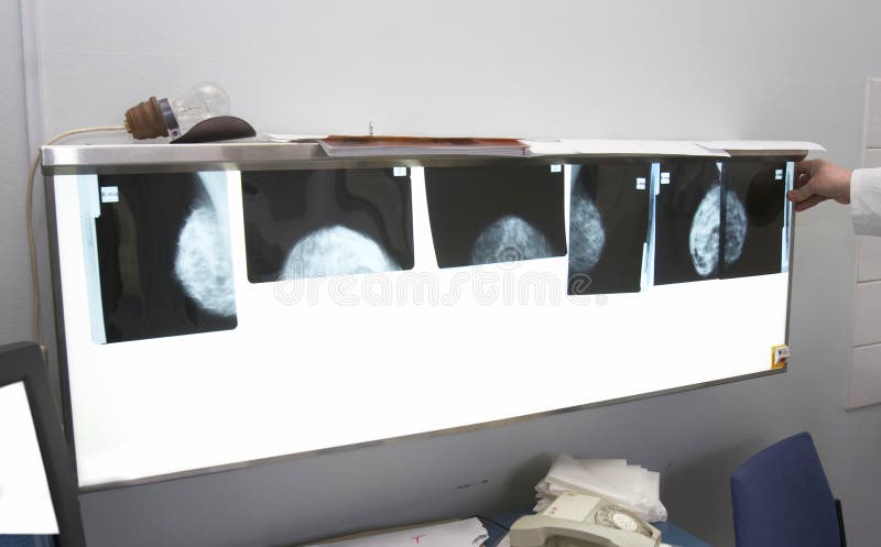 Breasts x-ray in a x-ray lab exposed. Breasts x-ray in a x-ray lab exposed