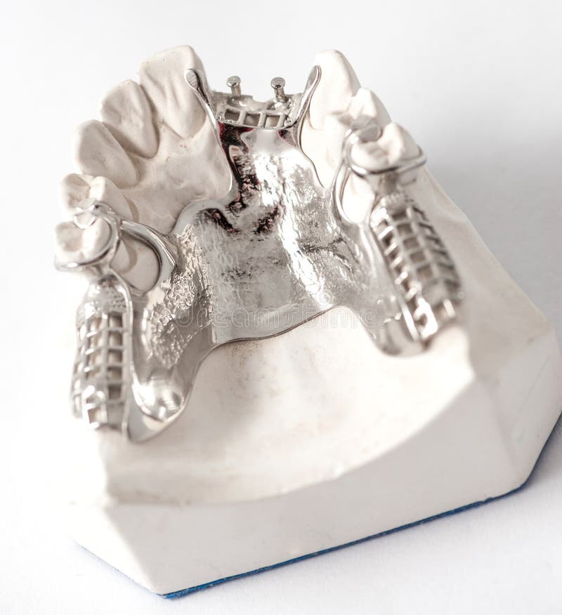 Abaissez le dentier partiel avec des attachements image libre de droits Abaissez le dentier partiel avec des attachements image libre de droits