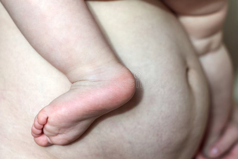 The abdomen of a woman after several months after childbirth, the baby`s legs against the background of the belly