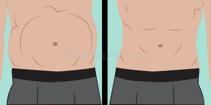 Reducir hinchazón abdominal