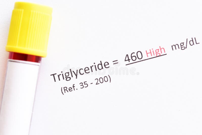 Abnormal high triglyceride test result royalty free stock photos Abnormal high triglyceride test result royalty free stock photos