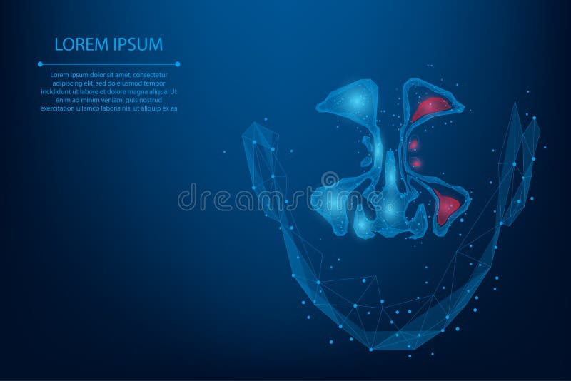 Abstract netwerk en punt Sinusitis Lage poly Gezonde en ontsteking neussinus royalty-vrije illustratie Abstract netwerk en punt Sinusitis Lage poly Gezonde en ontsteking neussinus royalty-vrije illustratie