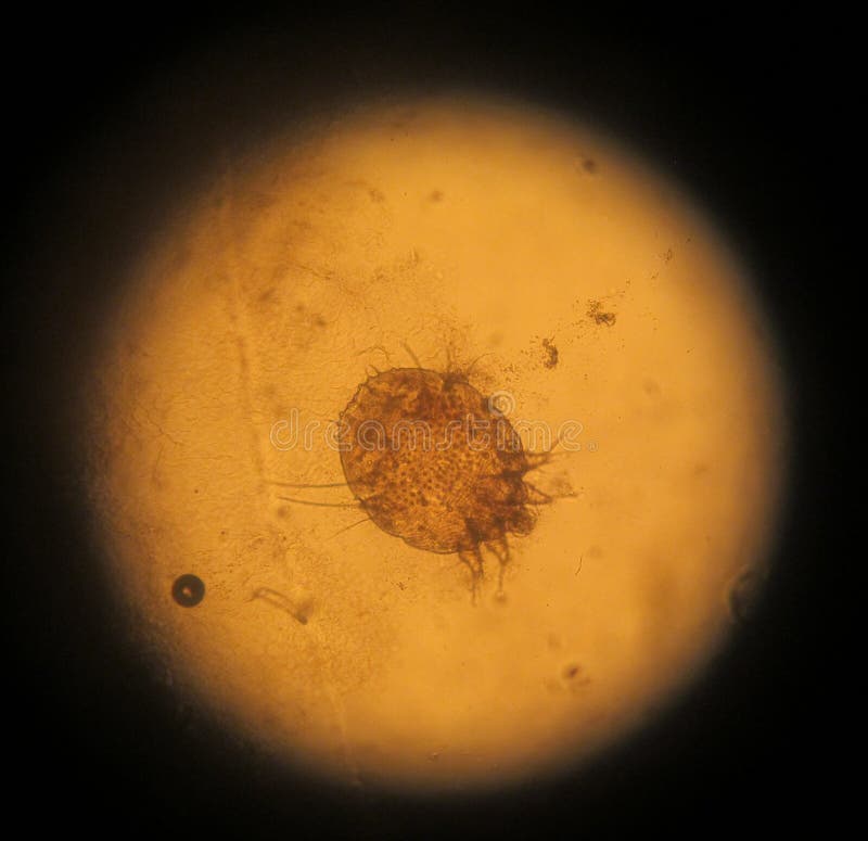 Acarides de Scabies (sept-an-démangez) image libre de droits Acarides de Scabies (sept-an-démangez) image libre de droits