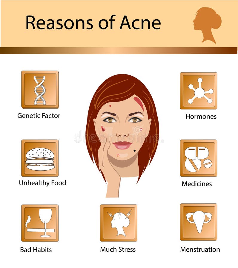 Acne Reasons. Skin Problems And Diseases Beauty Infographics ...