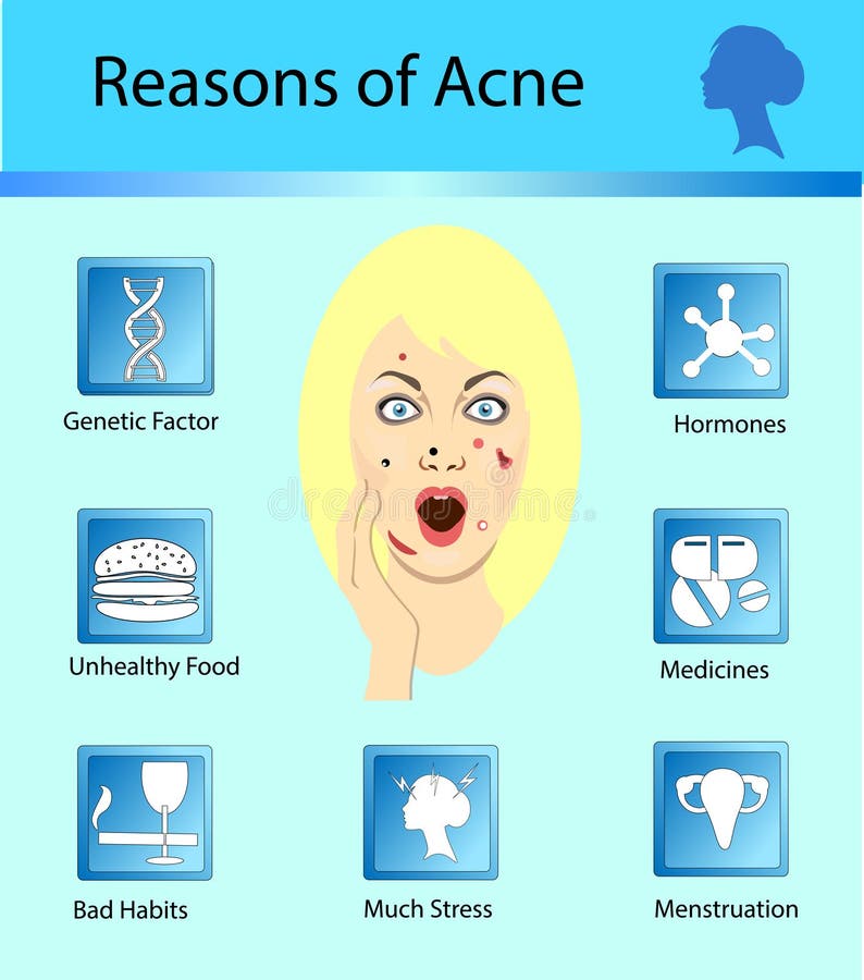 Reasons For Acne Chart