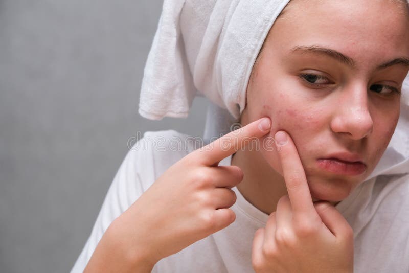 verificando a pele do rosto problemática em casa. jovem adolescente com  problemas de auto olhando no espelho. menina com baixa auto-estima  verificando sua pele em um espelho 16677990 Foto de stock no