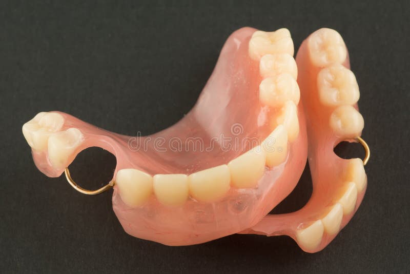 Acrylic Dental Prosthesis with Metal Retaining Elements Stock Image