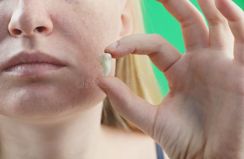 Actitud borrosa de una mujer con dolor de muelas y de una mano que sostiene el diente extraído, hocus en la mano foto de archivo Actitud borrosa de una mujer con dolor de muelas y de una mano que sostiene el diente extraído, hocus en la mano foto de archivo