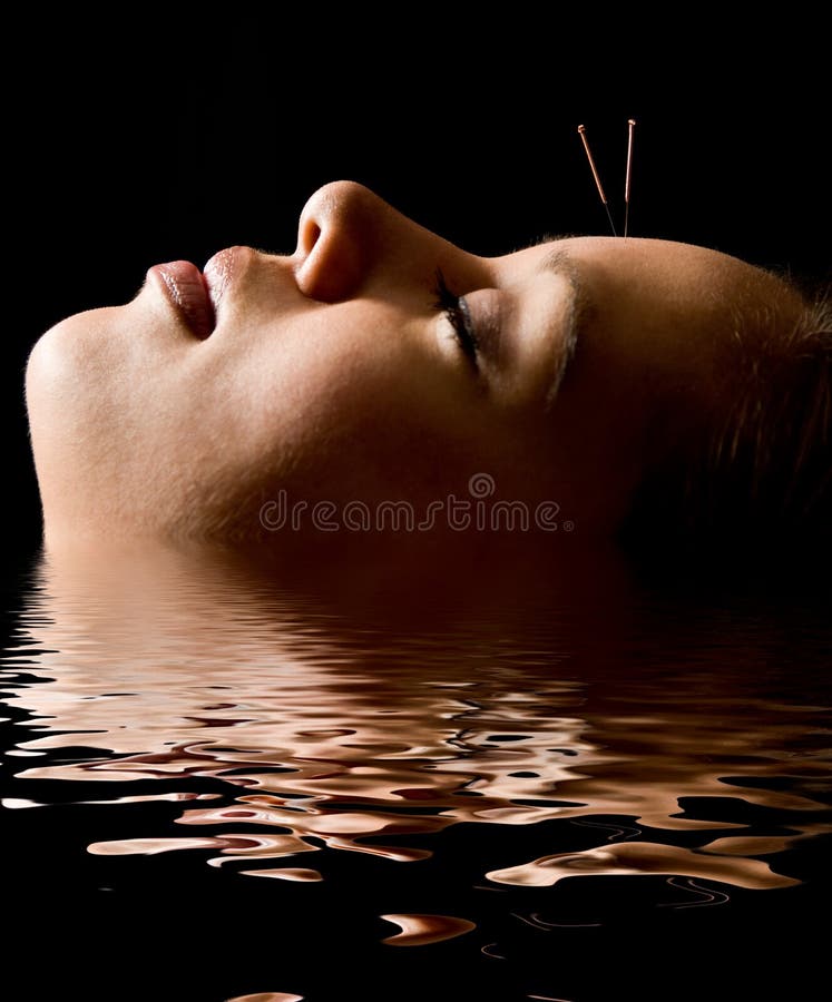 Acuponcture photos stock Acuponcture photos stock