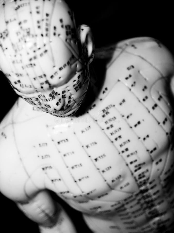 Acupuncture Concept stock photo. Image of therapist, medical 9982094