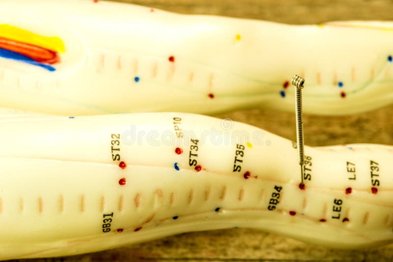 Acupuncture Stomach Stock Photos Free & RoyaltyFree Stock Photos